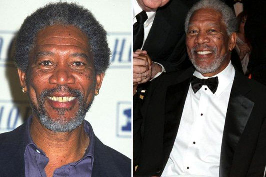 Morgan Freeman before and after smiles.